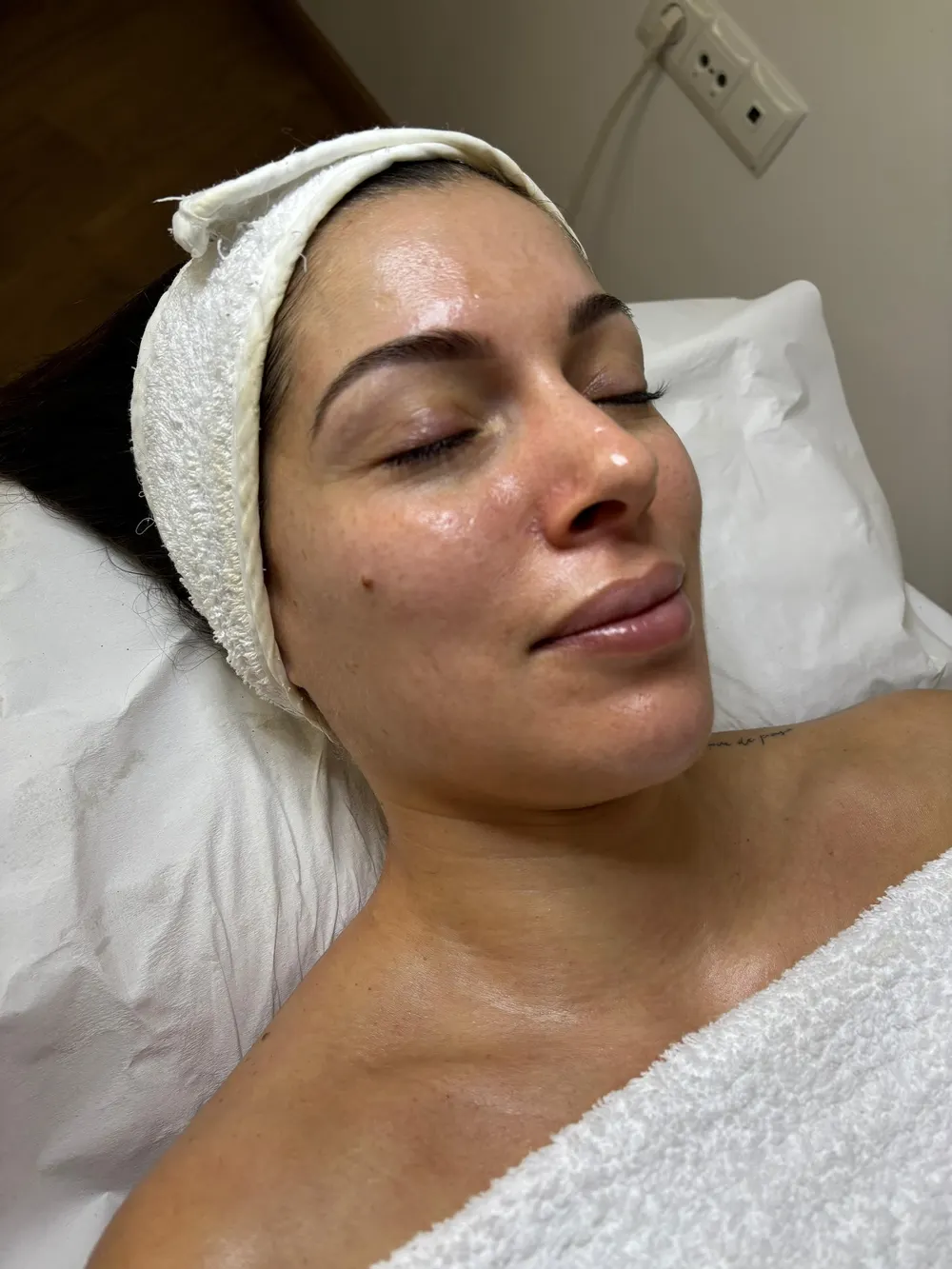 Paciente relajada durante un tratamiento facial en Olimpia